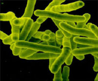 Biosensor - tuberculosis