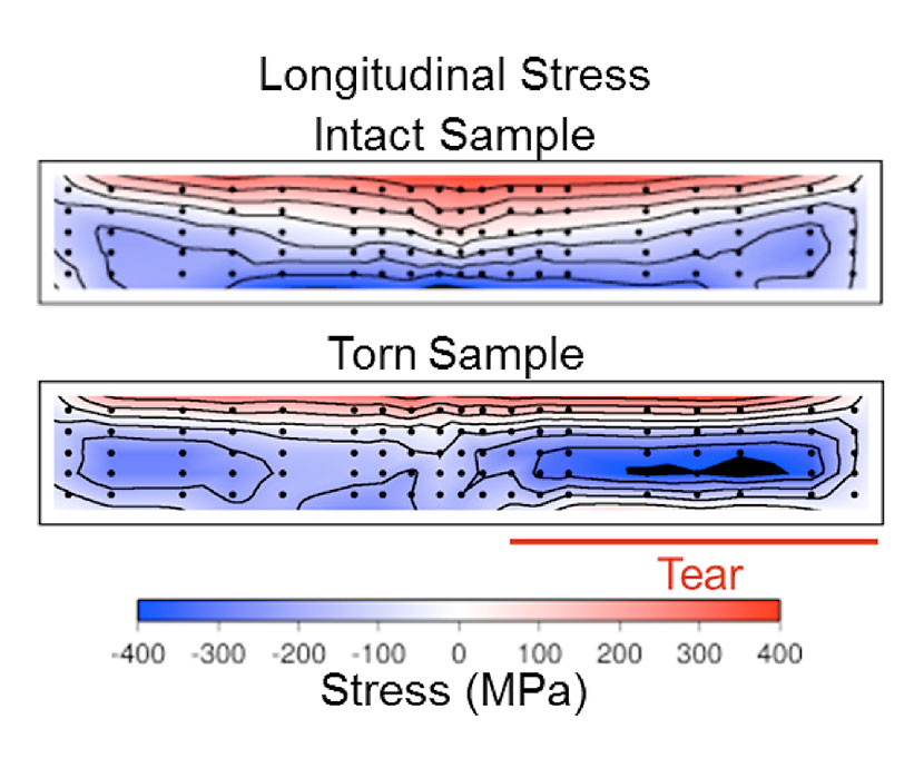 Data show that stress in the intact sample provides a large bending moment